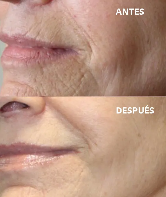 Enpitsu antes despues